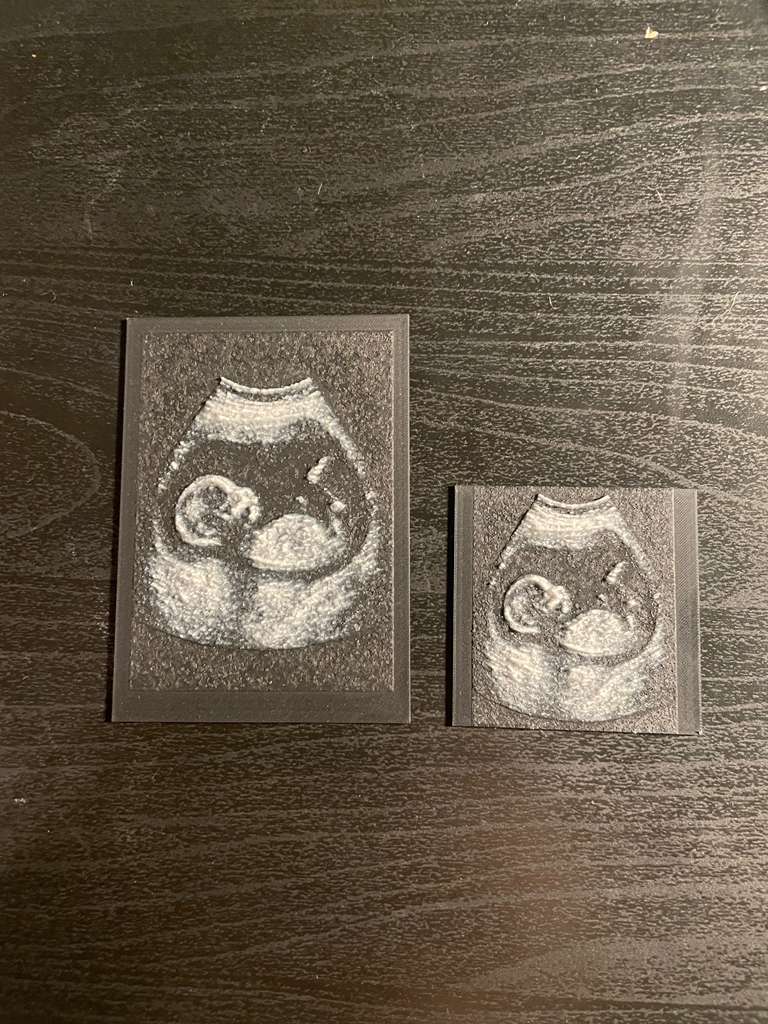 3D Printed Ultrasounds