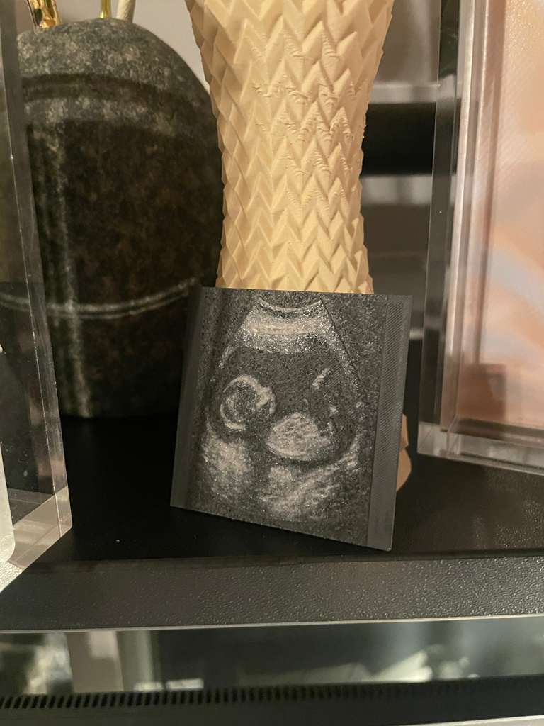 3D Printed Ultrasounds