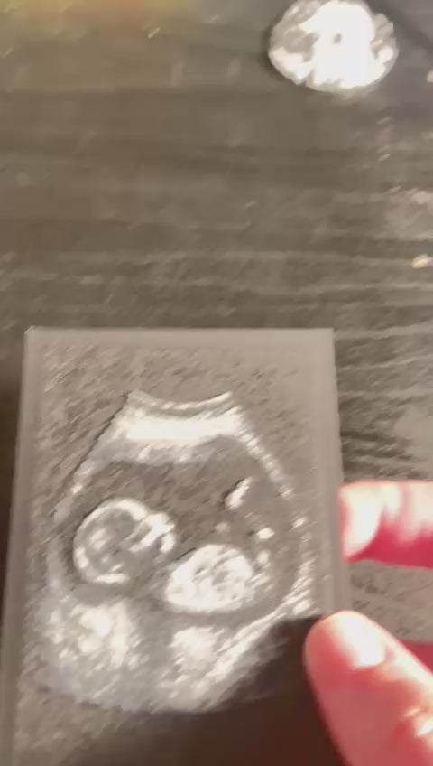 3D Printed Ultrasounds